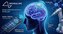 Neuralink passe à l'échelle supérieure : 21 patients désormais intégrés aux essais cliniques Neuralink passe à l'échelle supérieure : 21 patients désormais intégrés aux essais cliniques