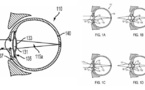 Google veut intégrer un ordinateur dans votre œil